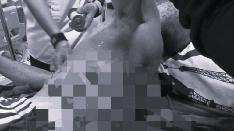 Kakek di Surade Sukabumi Tertusuk Bambu, Berjuang Hidup Setelah Perutnya Robek