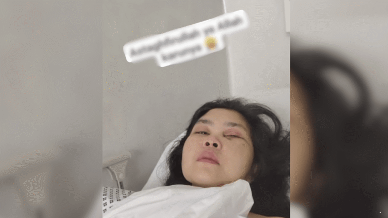 Viral Video PMI Asal Tegalbuleud Sukabumi Terbaring Lemah di Dubai, Diduga Jadi Korban Penganiayaan Majikan