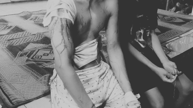 2 Wisatawan Asal Cianjur Diserang Saat Berkemah di Pantai Cibuaya Sukabumi, Pelaku Bersenjata Golok